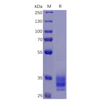 Human SLAMF3 Protein, hFc Tag
