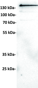 Anti-ROR2 antibody(DM174), Rabbit mAb
