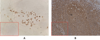 Anti-BAFF-R antibody(DM143); Rabbit mAb