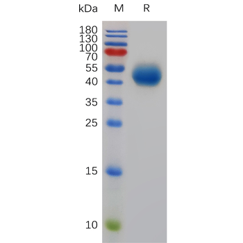 Human TSPAN8 Protein, hFc Tag