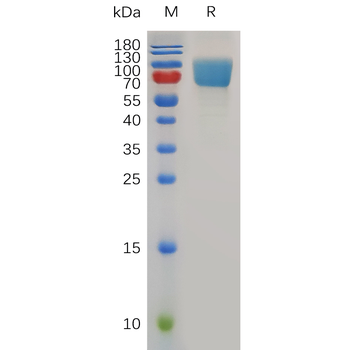 Human IL18BP Protein, hFc Tag