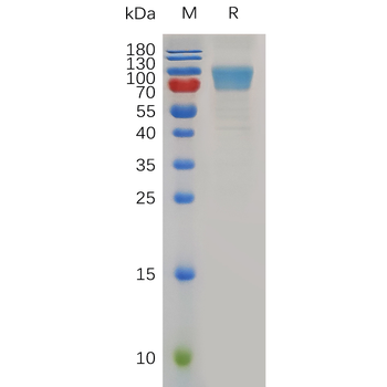 Human BMP6 Protein, His Tag