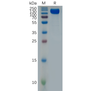 Human HSD17B13 Protein, Flag Tag