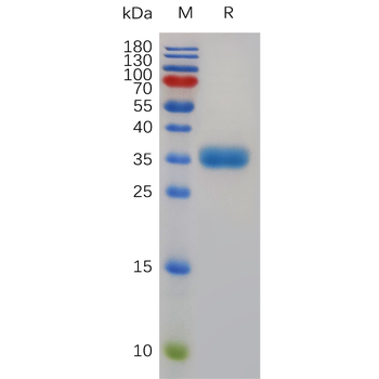 Human GPR87 Protein, mFc Tag