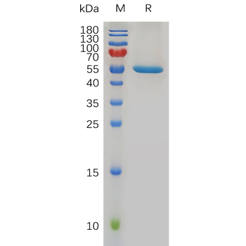 Human CCR2 Protein, mFc Tag