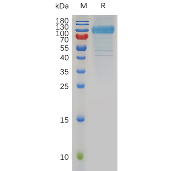 Human GPRC5C Protein, mFc Tag