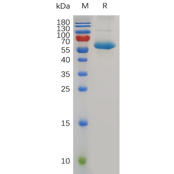 Human GPRC5B Protein, mFc Tag