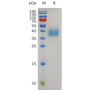 Human GPRC5A Protein, mFc Tag