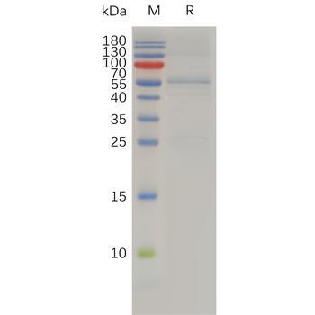 Human CCR6 Protein, mFc Tag