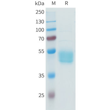 Mouse ROR1 Protein, His Tag