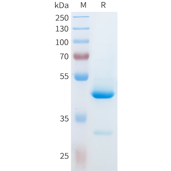Mouse CEACAM5 Protein, His Tag
