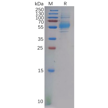 Human TREM1 Protein, hFc Tag