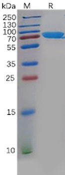 Human LAMP5 Protein, hFc Tag