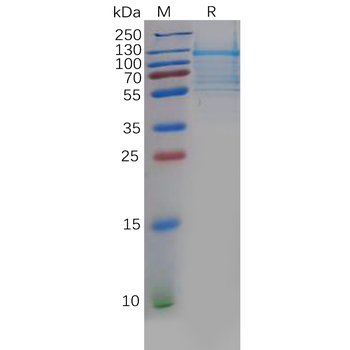 Human NTS Protein, hFc Tag
