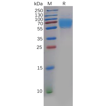 Human PLAUR Protein, His Tag