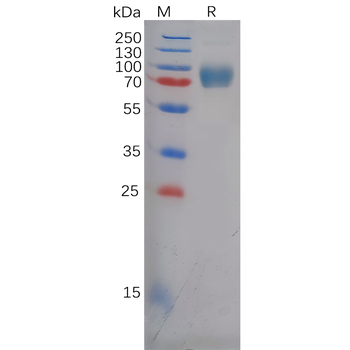 Human NRP1 Protein, His Tag