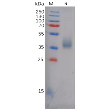 Human PGLYRP1 Protein, His Tag