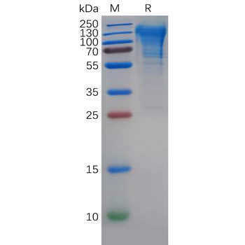 Human CA12 Protein, hFc Tag