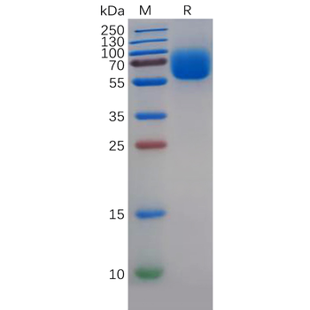 Human AGR2 Protein, hFc Tag