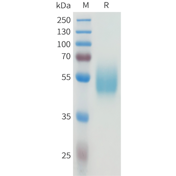 Mouse IL17RA Protein, His Tag
