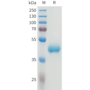 Mouse SIRPa Protein, His Tag