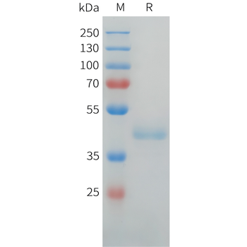 Mouse ADAM28 Protein, hFc Tag