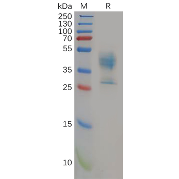 Human ITGAX and ITGB2 Heterodimer Protein, His Tag and hFc Tag
