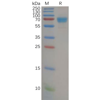 Human RNF43 Protein, mFc Tag