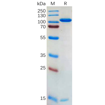 Human GPR55(1-21) Protein, hFc Tag