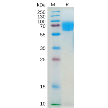 Human MDK Protein, hFc Tag