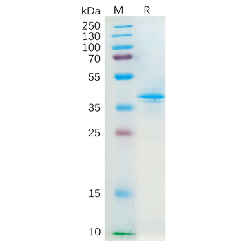 Human LRIG1 Protein, His Tag