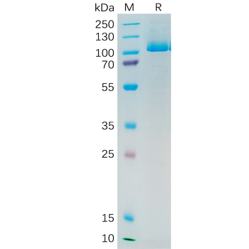 Human PRNP Protein, hFc Tag