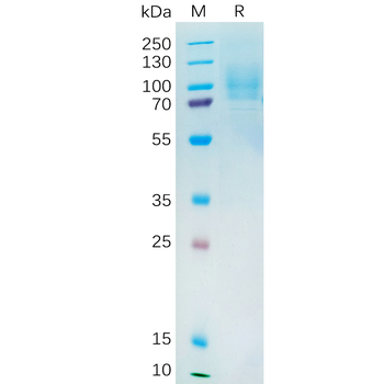 Human FLT1 Protein, His Tag