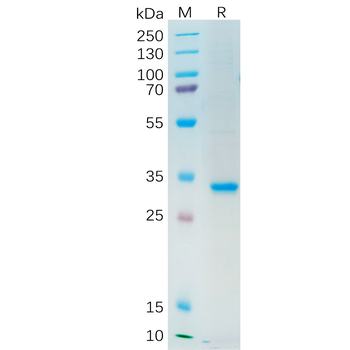 Human TEM1 Protein, His Tag