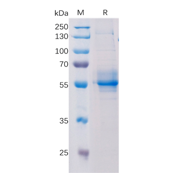 Human NPC1L1 Protein, His Tag
