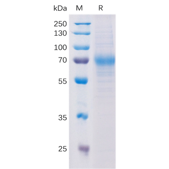 Human STAB1 Protein, His Tag