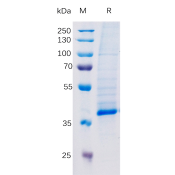 Human ITGA2 and ITGB1 Heterodimer Protein, His Tag and hFc Tag