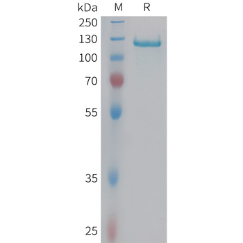 Cynomolgus ANXA2 Protein, His Tag