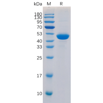 Human ITGB1 Protein, hFc Tag