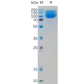 Human ITGA2 Protein, His Tag
