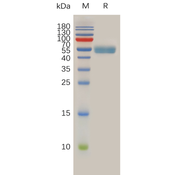 Human ZP3 Protein, hFc Tag