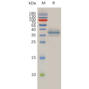 Human SCGB2A2 Protein, hFc Tag