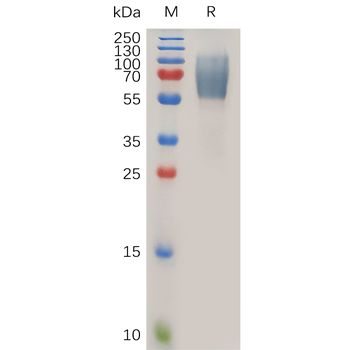 Human CCR3 Protein, hFc Tag