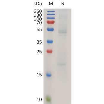 Human CT83 Protein, hFc Tag