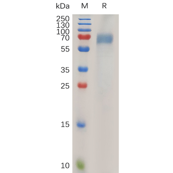 Human TIE2 Protein, hFc Tag