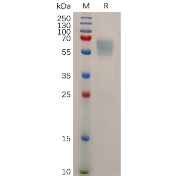Human FLT1 Protein, hFc Tag