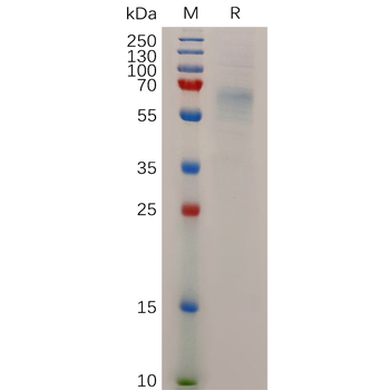 Human TGFBR2 Protein, hFc Tag