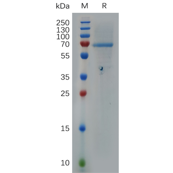 Human ROBO1 Protein, hFc Tag