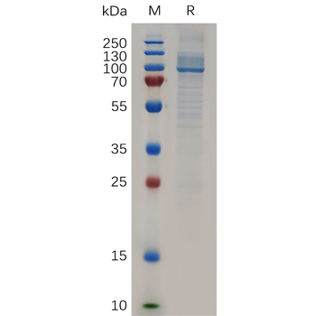 Human RHOC Protein, hFc Tag