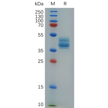 Human PTGER2 Protein, hFc Tag